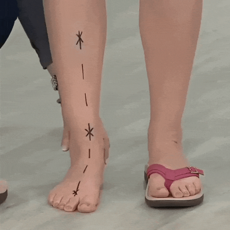 Sandales d'été ortho+