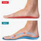 Semelles ortho+